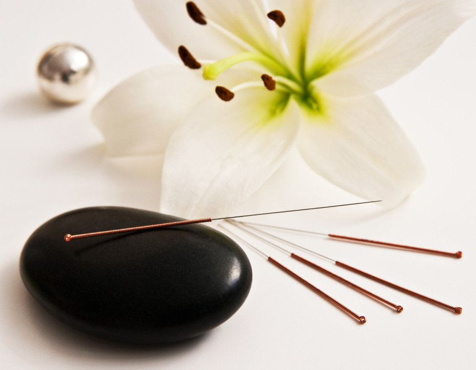 ACUPUNTURA
