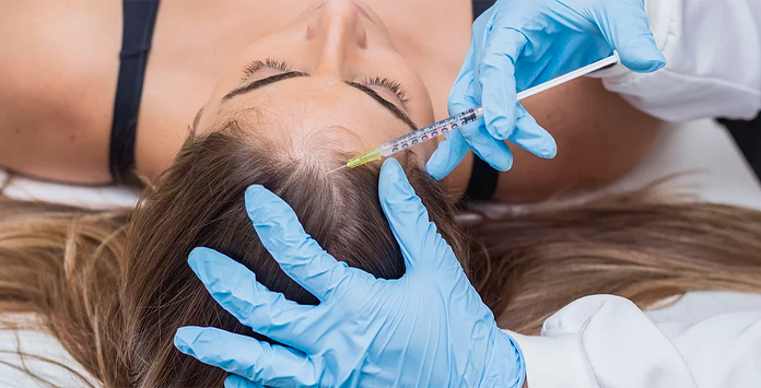 MESOTERAPIA CAPILAR