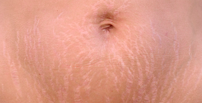 JATO DE PLASMA